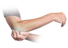 Elbow Arthrolysis